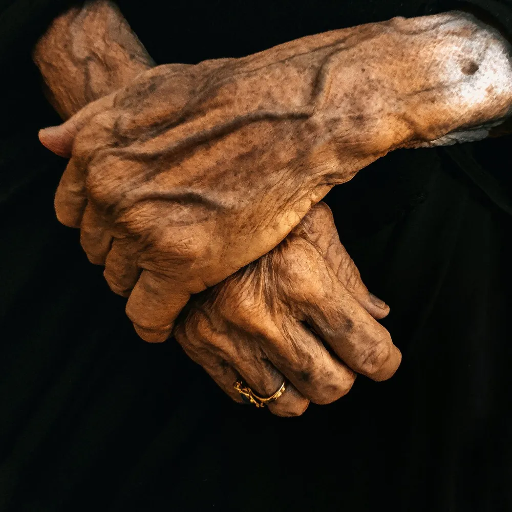 Mãos de uma pessoa idosa, cruzadas com calma